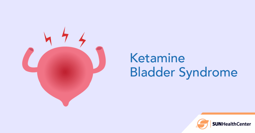 Ketamine Bladder Syndrome - What is it?